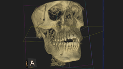 Introduction to Dental Medicine