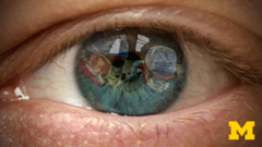 Introduction to Cataract Surgery