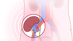 Clinical Kidney Transplantation 